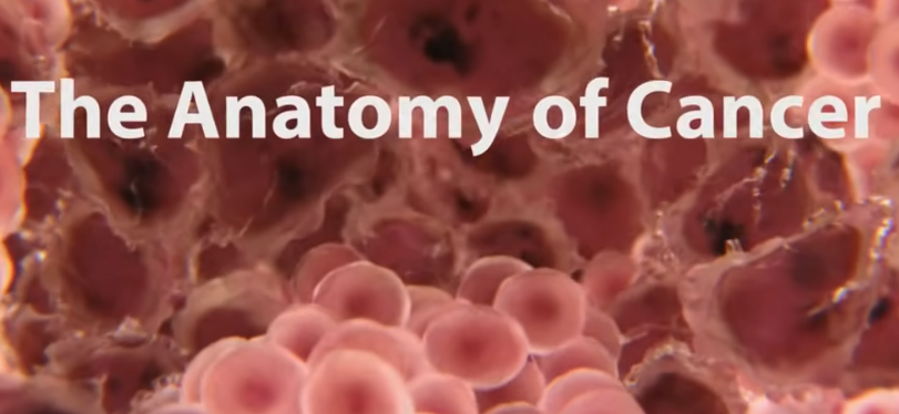 What is Cancer - What Causes Cancer & How Is It Treated?